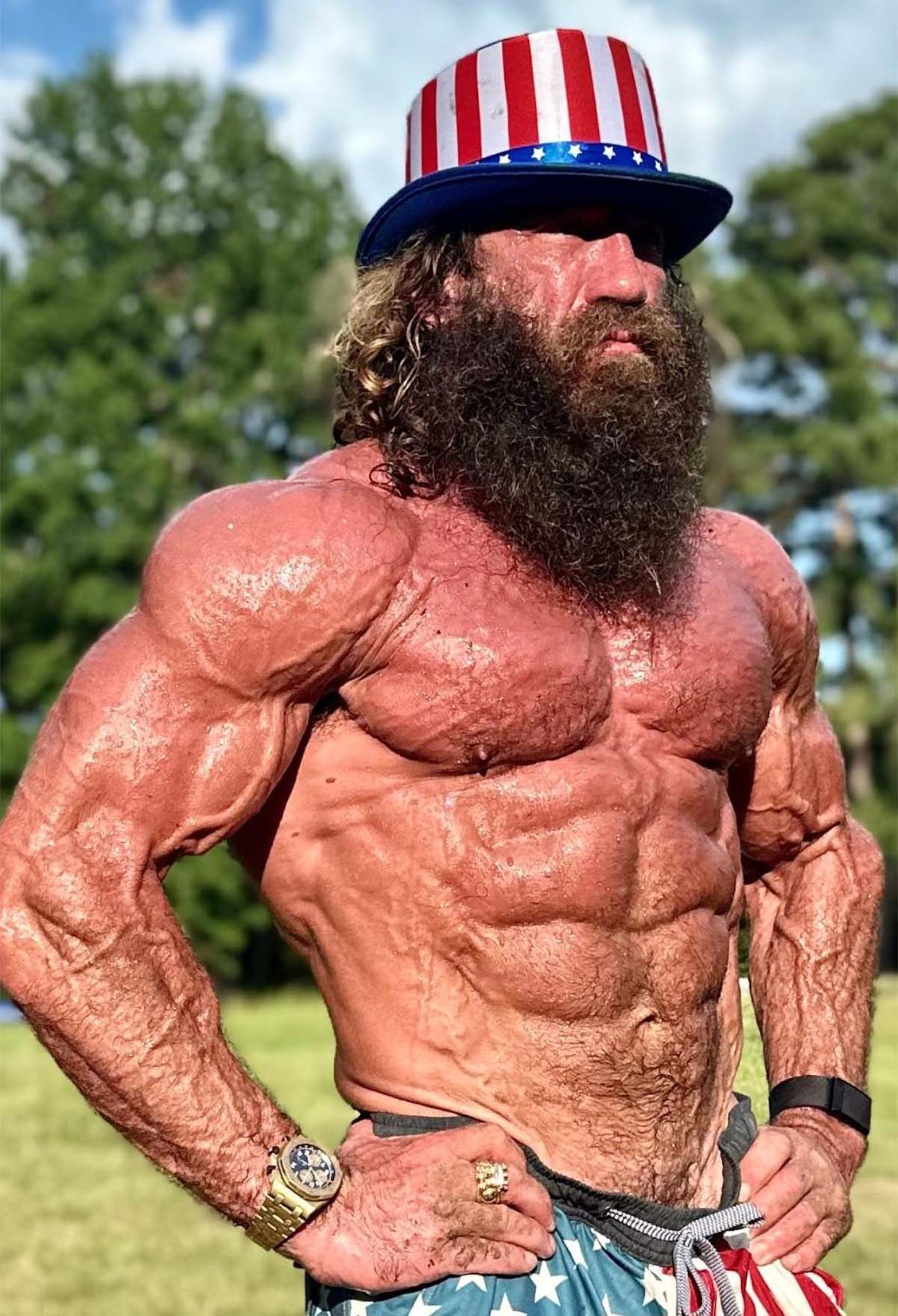 Liver King's Ab Implants and Centerpiece Six Pack Secrets